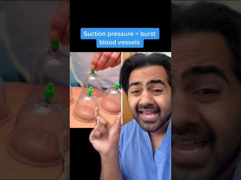 Paralysed from a Hickey #shorts