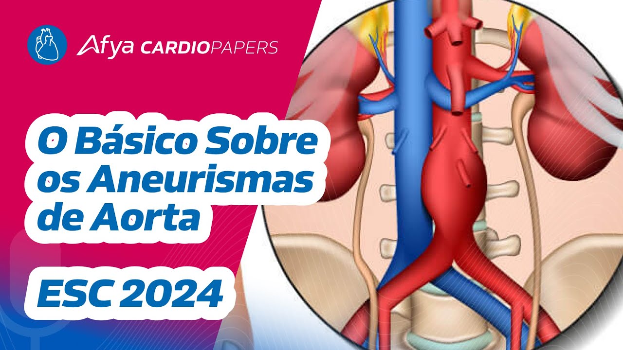 O básico sobre os aneurismas de aorta - Diretriz ESC 2024
