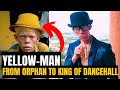 Yellowman: From Abandoned Orphan to King of Dancehall | The Untold Story of a Jamaican Legend