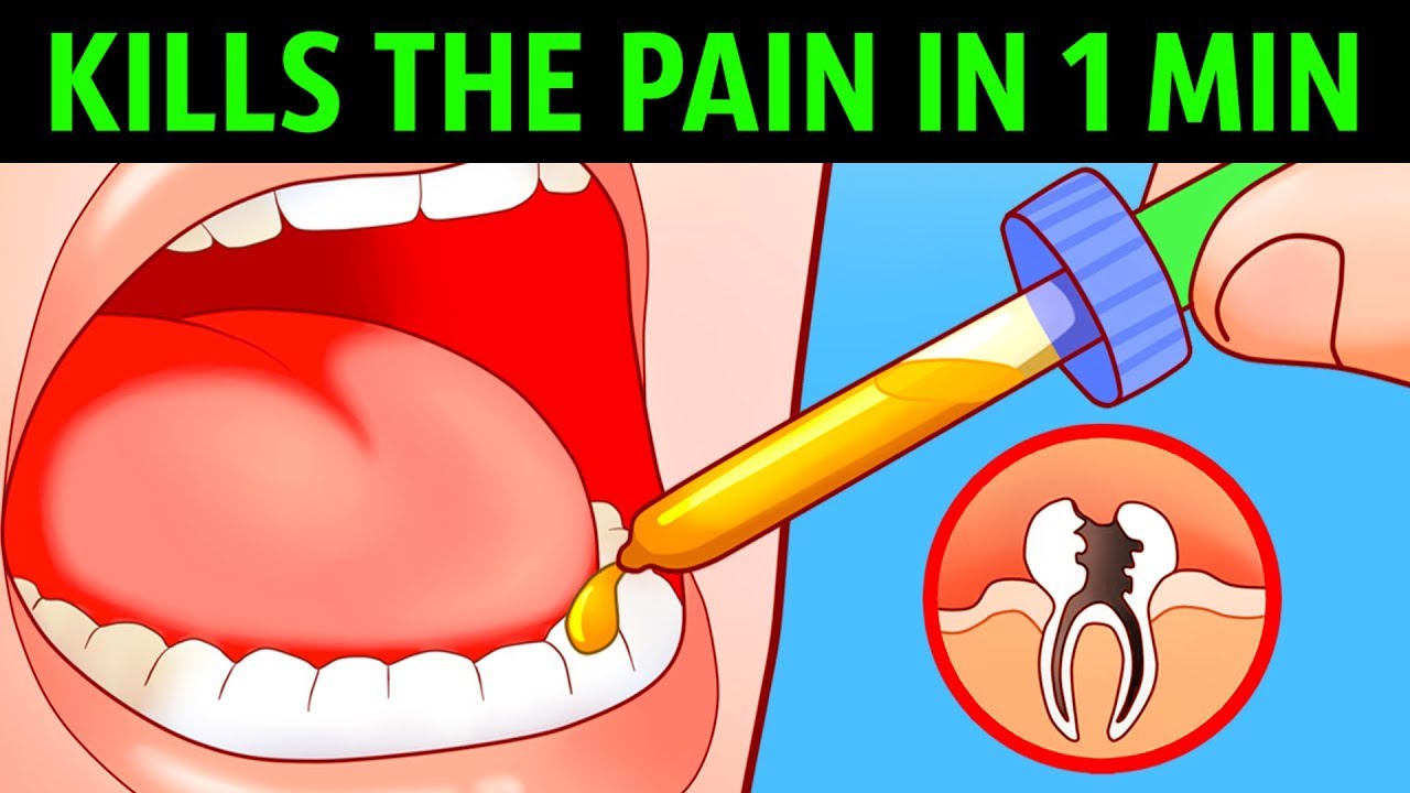 10 Ways to Kill a Toothache In a Minute