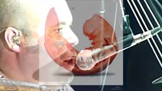 Allergies  An Unofficial BNL Video Slideshow