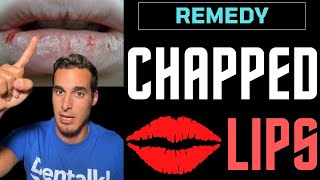 CHAPPED LIPS - Causes and REMEDIES for cracked lips