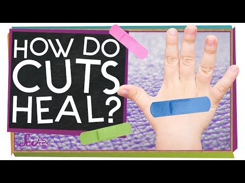 How Do Cuts Heal?