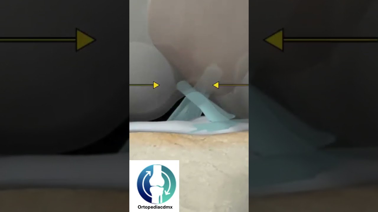 Carlos Ignacio Muñoz Valadez-54