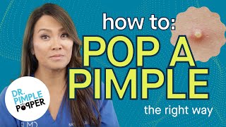 How to Pop a Pimple the RIGHT Way | Dr. Pimple Popper | SLMD Skincare