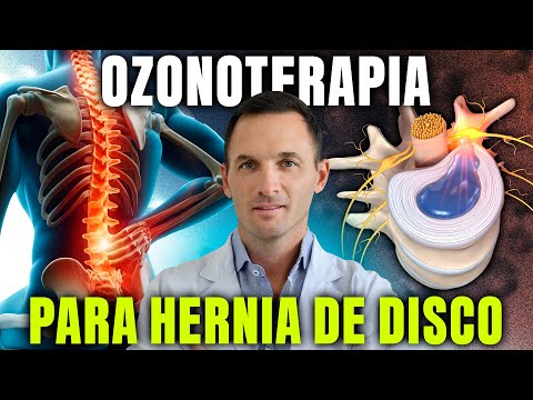 Unguenti riscaldamento gel articolazioni Unguento hondroksid con ernia intervertebrale