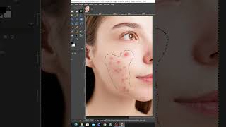 shorts// face pimpel remove in gimp