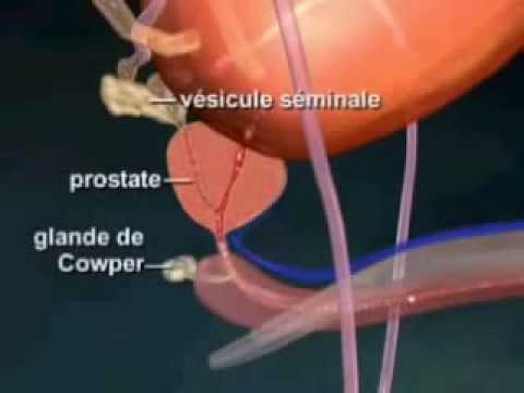 comment traiter prostate