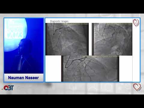 FFR Practical Tips & Tips by Nauman Naseer