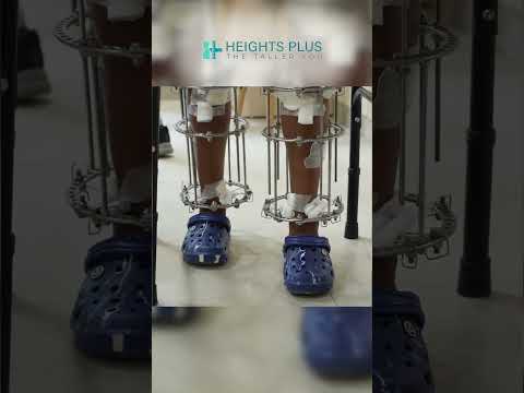 Heights Plus Patient Success Story YouTube Short Cover