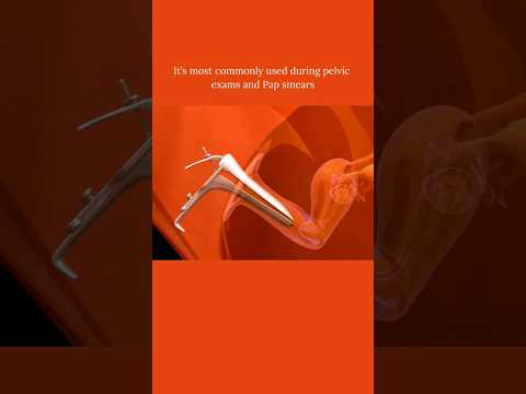 Cusco's Speculum 🤔 #share #foryou