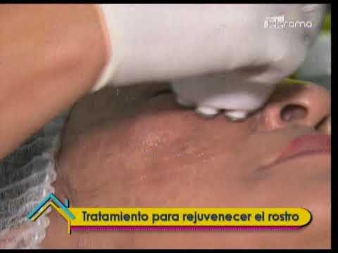 Tratamiento para rejuvenecer el rostro