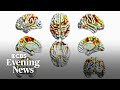 How Smartphone Addiction May Be Hurting Our Brains