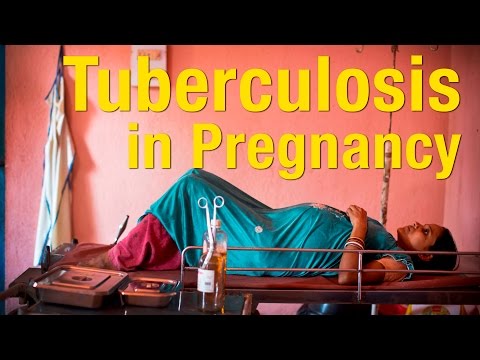 image-How many people died from tuberculosis in 2019?