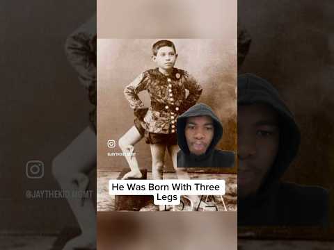 He was born with 3 LEGS…no diddy 🤦🏽‍♂️