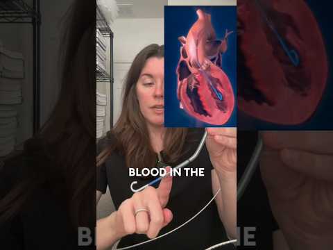 IMPELLA CP: How It WORKS! #tutorial #science #cathlab #impella