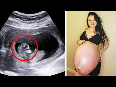 Lékař okamžitě zavolal policii, když si na ultrazvuku těhotné ženy všiml děsivý detail...