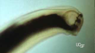 New Drug Prospect Offers Hope against Hookworm Infections