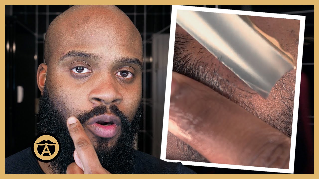 4 Ways to NEVER Get Ingrown Hairs Again