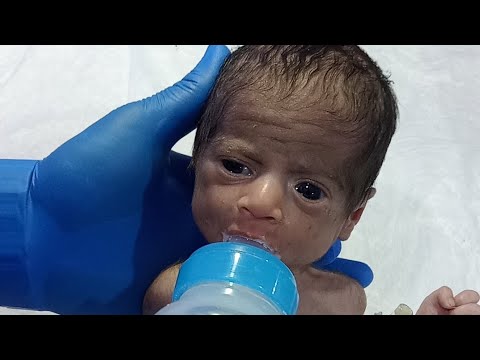 How to Feed a Newborn Baby with Bottle in NICU | Proper Cleaning & Care