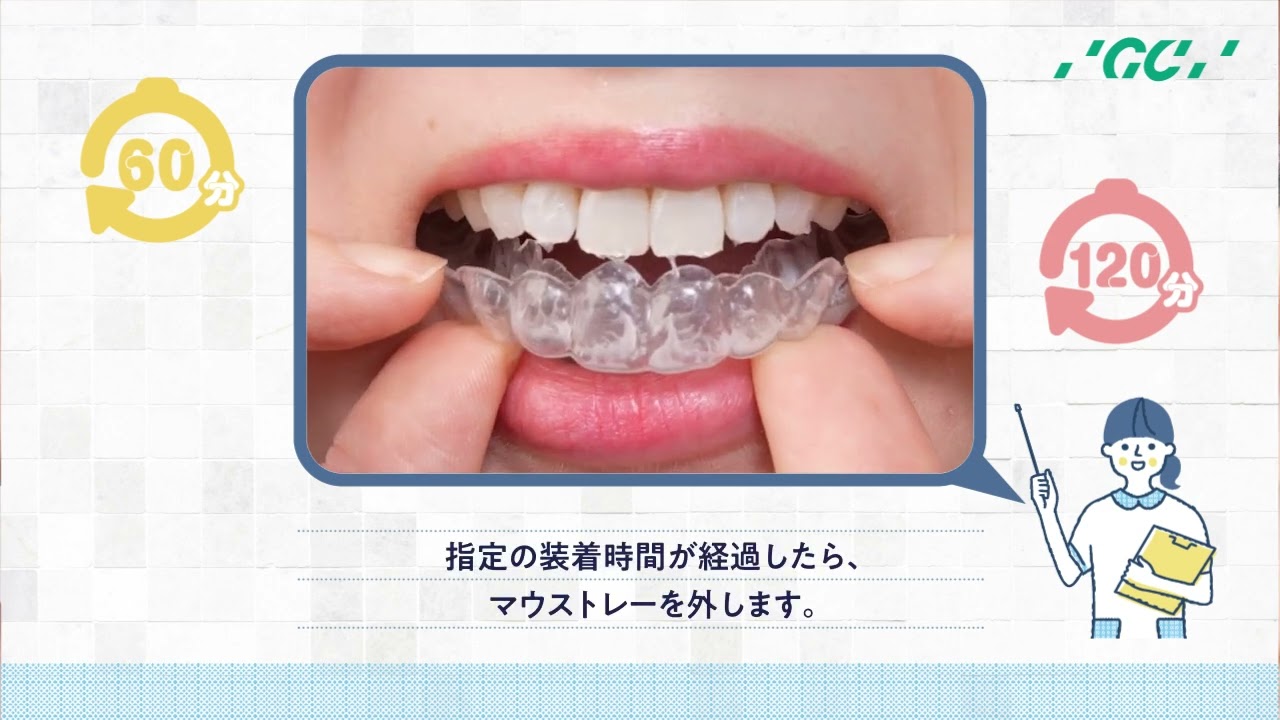 ホームホワイトニングの使い方　川本歯科医院