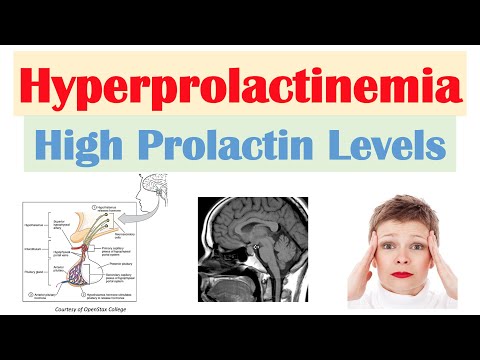 Hyperprolactinemia (High Prolactin Levels) | Causes, Signs & Symptoms, Diagnosis, Treatment