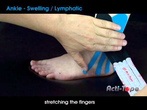 Acti-Tape - Ankle - Swelling / Lymphatic