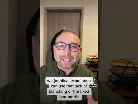 Livor Mortis