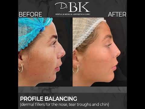 Christina's Profile Balancing Treatment