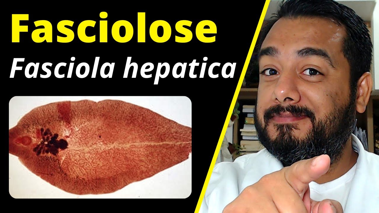 Fasciolose (Fasciola hepatica): o que é, ciclo, sintomas, diagnóstico | Curso de #Parasitologia