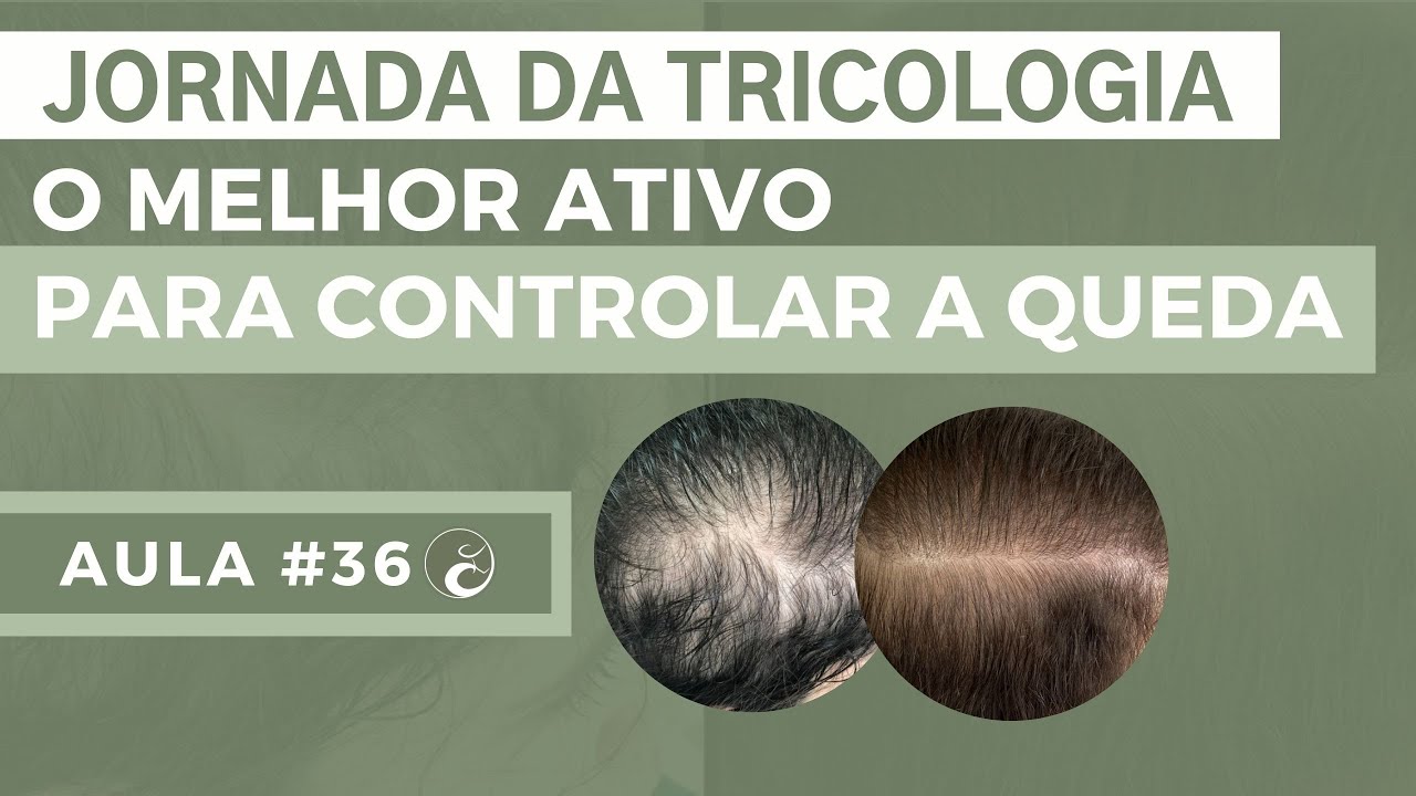 JORNADA DA TRICOLOGIA - Aula 36| O MELHOR ATIVO para tratar QUEDA CAPILAR