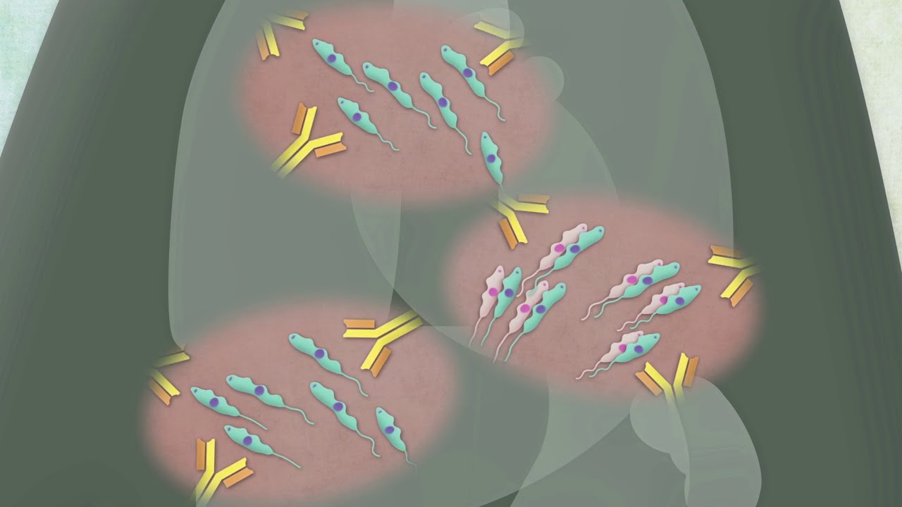 Grandes tueuses : La maladie du sommeil