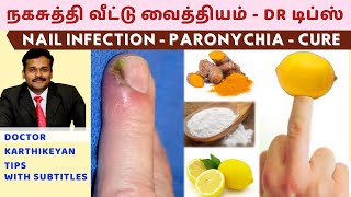 Download lagu நகசுத்தி வந்தால் குணமாக வீட்டு வைத்தியம்|nail skin infection home remedies paronychia dr karthikeyan mp3 Download lagu நகசுத்தி வந்தால் குணமாக வீட்டு வைத்தியம்|nail skin infection home remedies paronychia dr karthikeyan mp3