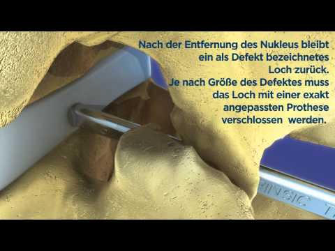 Rückenschmerzen Behandlung Bubnovsky Ñ € ÐμнÑ, гÐμн DD »D кÑ, Ñ, Ð ° Ð · оР± Ñ Ðμнного ÐμÐÑ € ÑƒÑ Ñ, Ð ° вР° d²