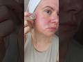 QURE MICRO-INFUSION SYSTEM FOR AMAZING SKIN 🩷 #microneedling #skincare #skincaretips #beauty