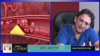 Ondas de choque de baja intensidad para disfunciones sexuales Dr  Daniel Amitrano   28 05 2022