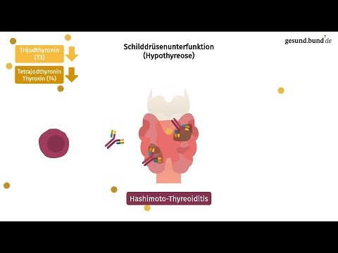 Welche häufigen Schilddrüsenerkrankungen gibt es?