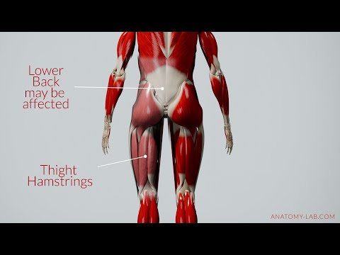 Tight Fascia? Break Crosslinks & Improve Flexibility