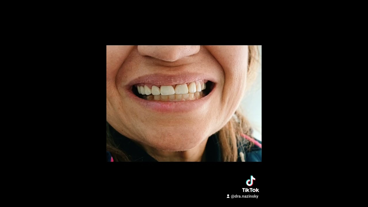 Nazinsky Rodriguez Arias-27