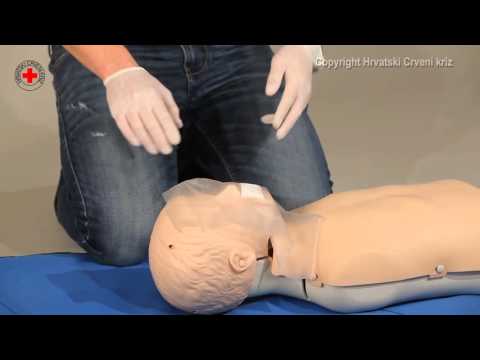 Oživljavanje – dijete