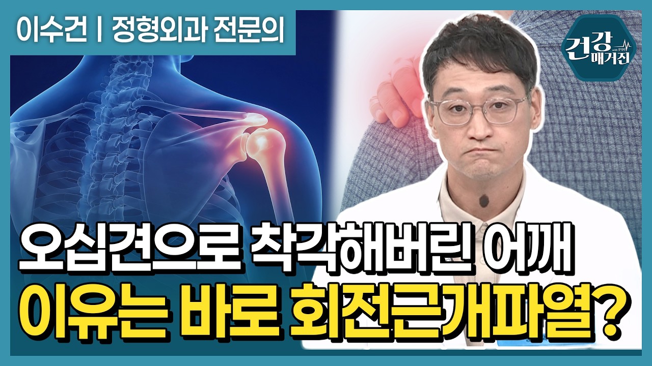 오십견으로 착각한 회전근개 파열, 증상부터 치료법까지 알아봅니다 [건강매거진]