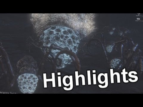 Bloodborne: Lower Pthumeru Chalice -F**k The Spiders