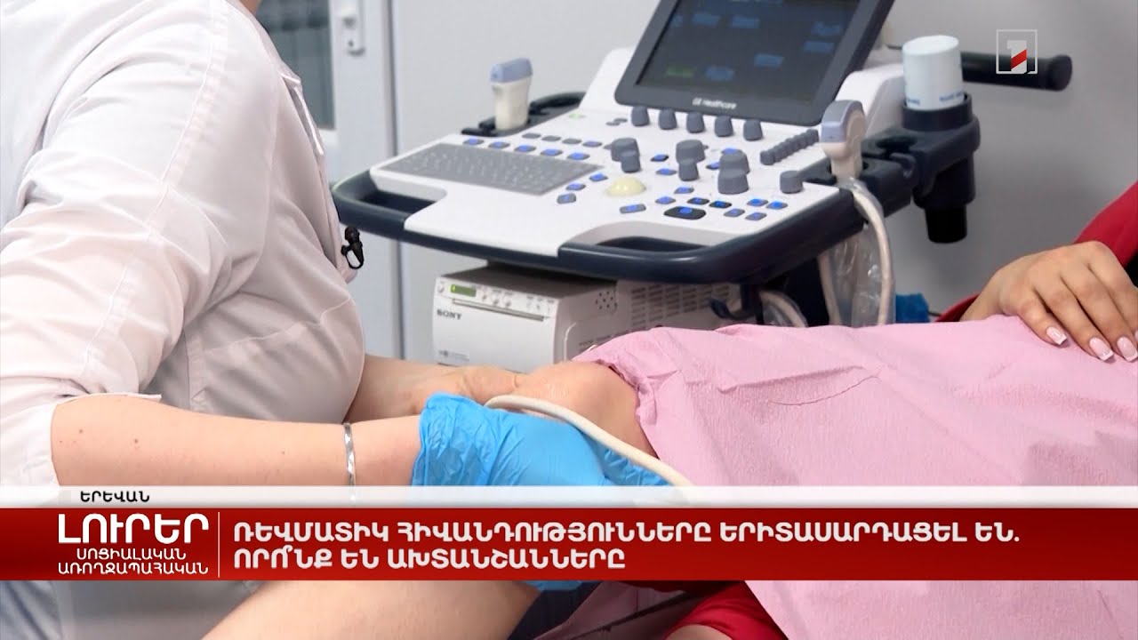 Ռևմատիկ հիվանդությունները երիտասարդացել են. որո՞նք են ախտանշանները