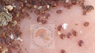 مقبرة الفاروا حمض الفورميك كارثة .... تساقط رهيب للفاروا بعد استخدام حمض الفور