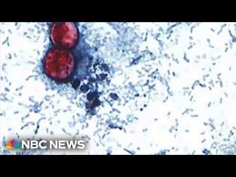 Cases of illness that causes explosive diarrhea on the rise across the U.S.