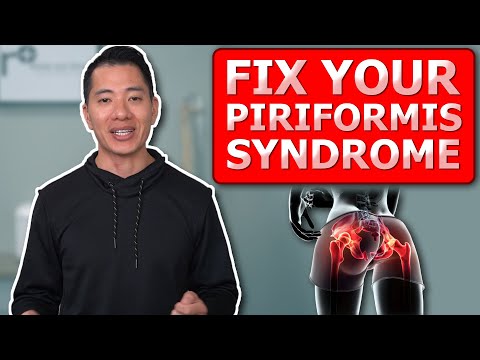 Alleviate AND Prevent Piriformis Syndrome With These Physical Therapy Tips and Exercises