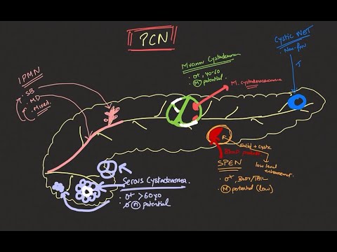 Pancreatic cystic neoplasms