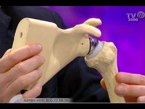 Ciò che lo sport fare osteocondrosi Giunti di Vladimir