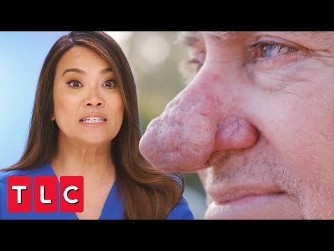 What your nose can tell you about external skin disease and internal health