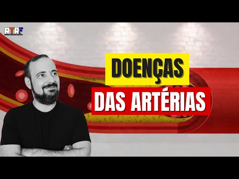 Doenças das artérias | José Góes